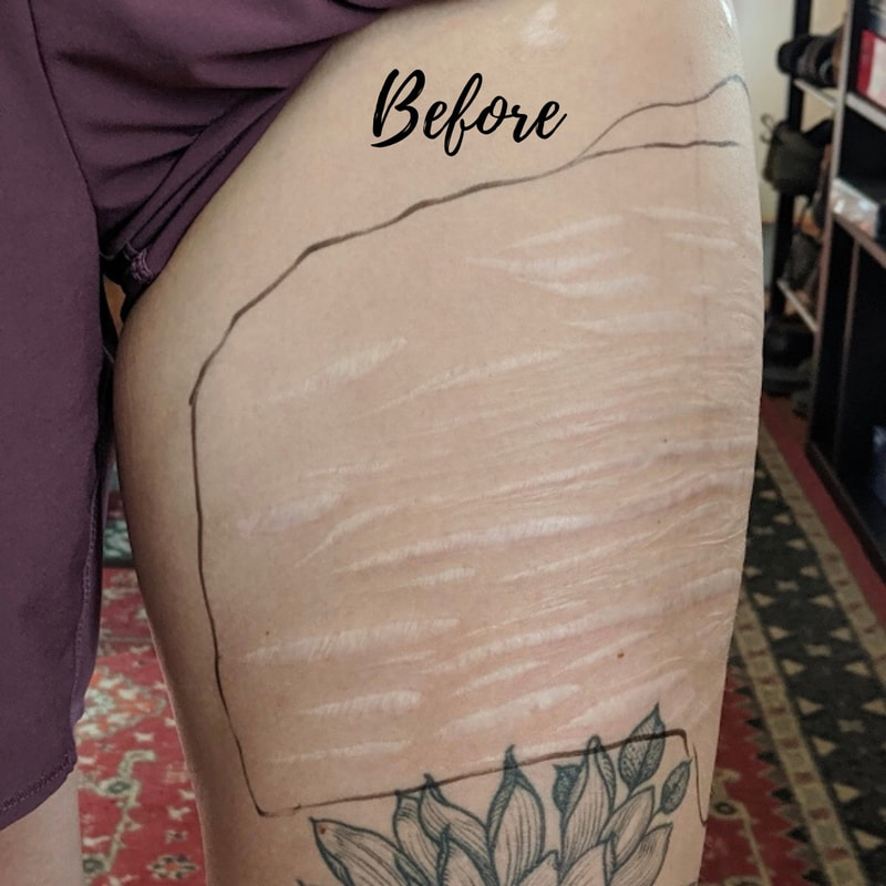 left tigh before