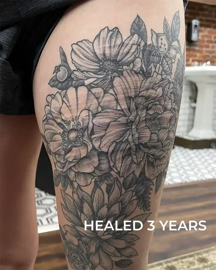healed scar coverup tattoo botanical dotwork floral tattoo by ruby gore in portland oregon